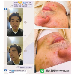 麗京美學 蘆洲臉部保養・清粉刺專業調理 麗京美學 蘆洲臉部保養・清粉刺專業調理