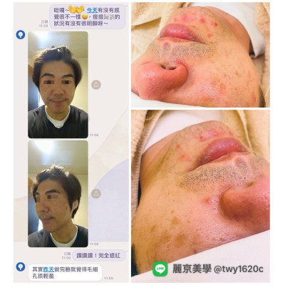 麗京美學 蘆洲臉部保養・清粉刺專業調理 麗京美學 蘆洲臉部保養・清粉刺專業調理