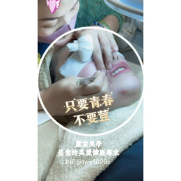 只要青春 不要荳 2026暑期學生肌膚保養專案 只要青春 不要荳 2026暑期學生肌膚保養專案